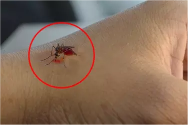 best hospital for malaria treatment in Katihar, best doctor for malaria treatment in Katihar, cost of malaria treatment in shahjahanpu